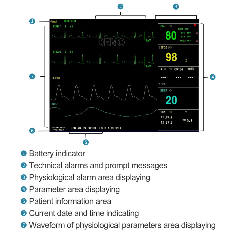 Moniteur patient portable