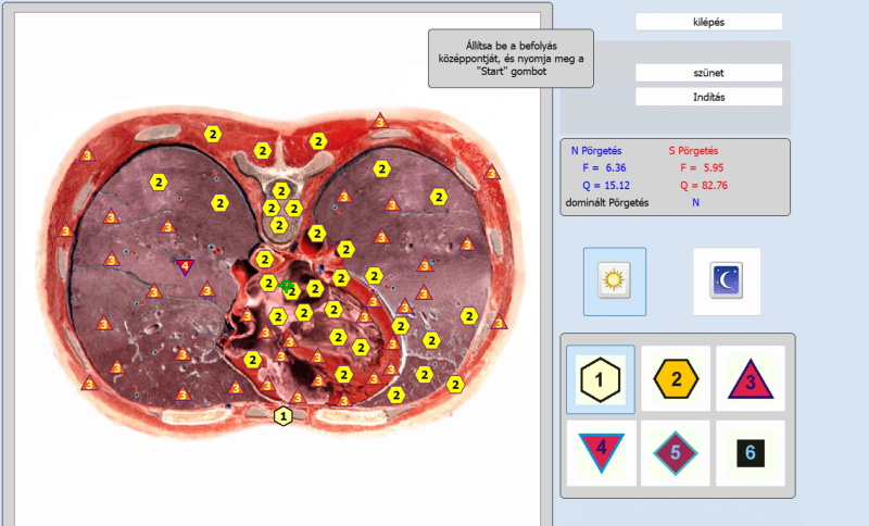 Quantum body analyzer