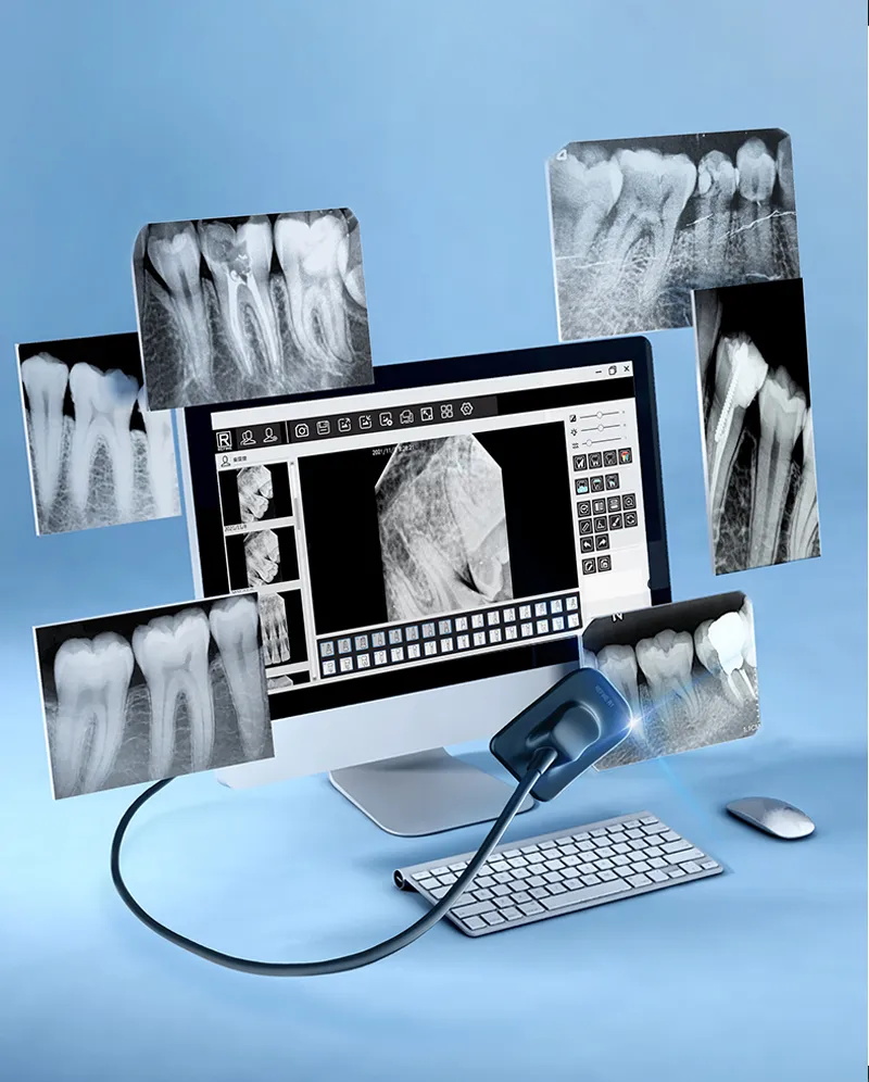 radiographie dentaire